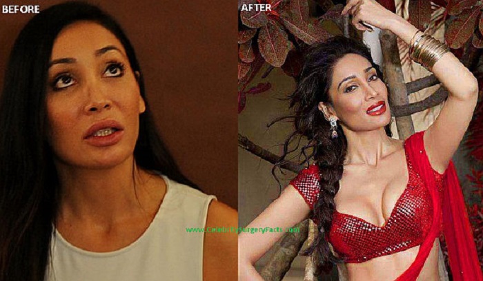  Photo Credit http://www.celebritysurgeryfacts.com/sofia-hayat-plastic-surgery-before-and-after-photos/