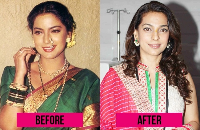 Photo Credit http://www.fashionlady.in/5-bollywood-plastic-surgeries-that-horribly-went-wrong/7180